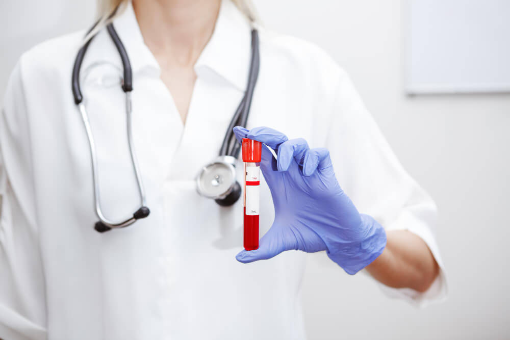 badania hormonalne – lekarka trzymająca w dłoni fiolkę z krwią