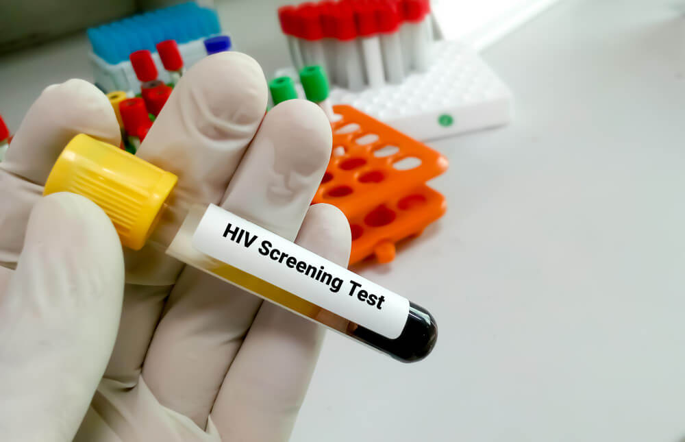 dłoń trzymająca fiolkę z krwią z napisem HIV Screening Test