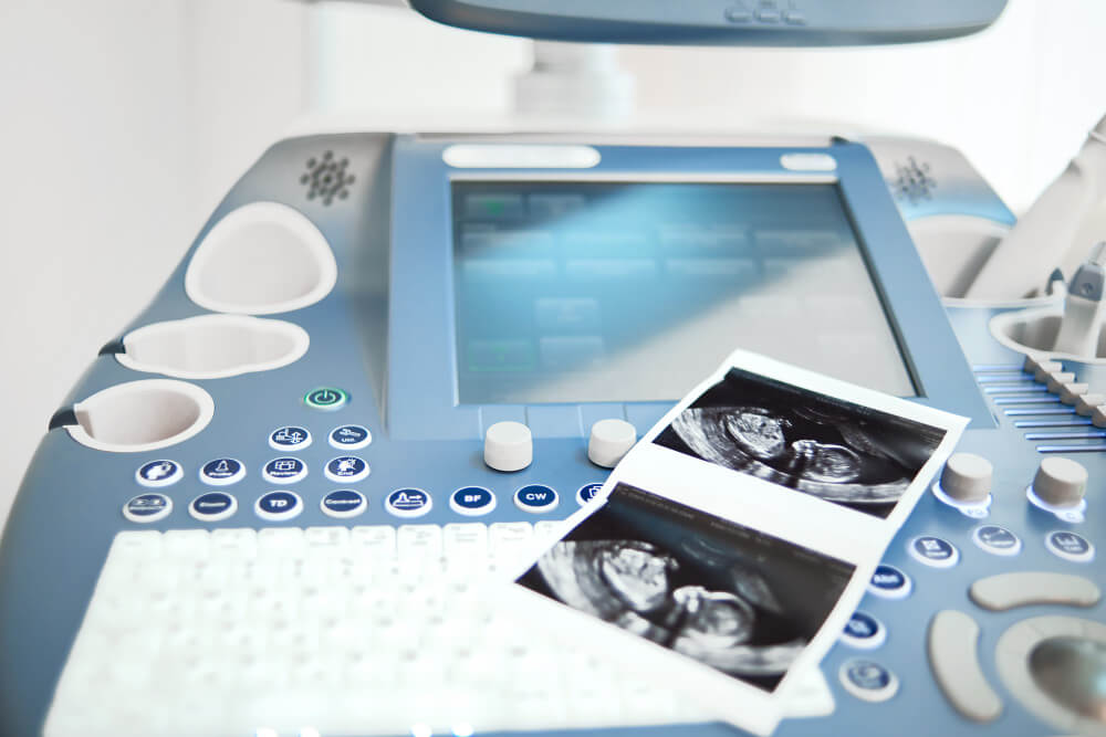 rak szyjki macicy a ciąża – ultrasonograf i zdjęcia USG płodu